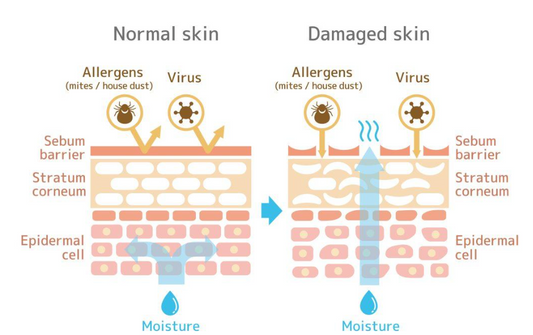 Ceramides in Skincare: The Small Lipids Making a Big Difference